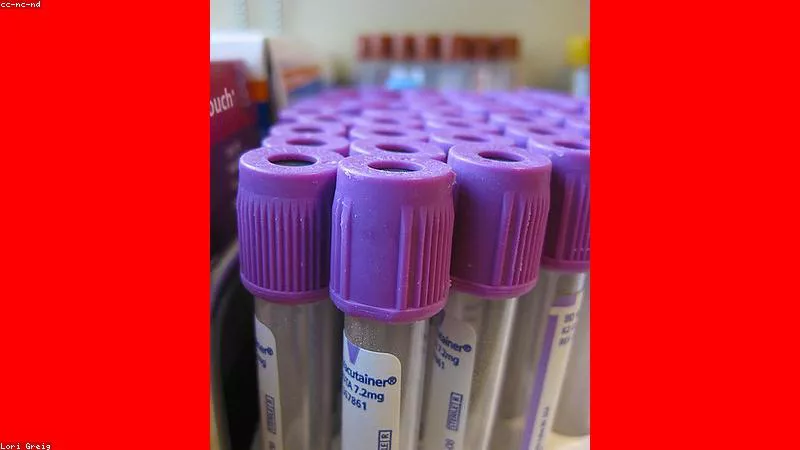Giải tỏa áp lực tâm lý lo âu hiệu suất cho nam giới trẻ tuổi